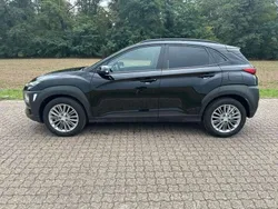 Schwarz Gebraucht 2018 Hyundai Kona SUV | 10.400 € (Fairer Preis)