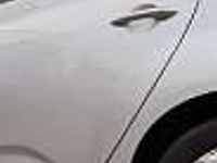 Używany Kia Venga 125 KM (91 kW) 2010 Inny kolor Hatchback